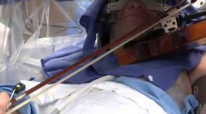 Playing violin while doctors play in your brain
